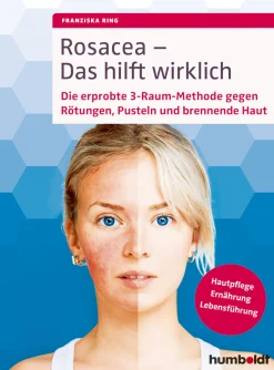 Rosacea - Das hilft wirklich: Die erprobte 3-Raum-Methode gegen Rötungen, Pusteln und brennende Haut : Hautpflege, Ernährung, Lebensführung.